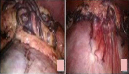 large serpentine feeding vessels